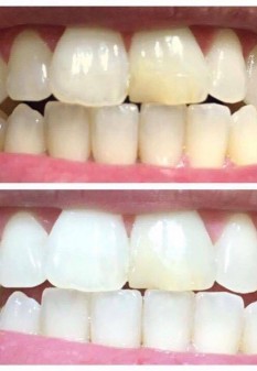  Whitening Fluoride Toothpaste